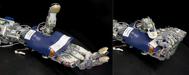 Advances in Prosthetic Devices