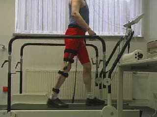 Man walking with free walk KAFO on treadmill