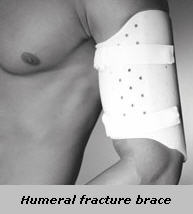 Humeral fracture brace